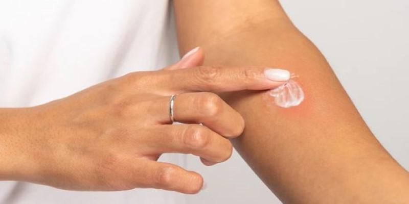Skin-Care Patch Test Basics: What It Is and Why It’s Worth the Time